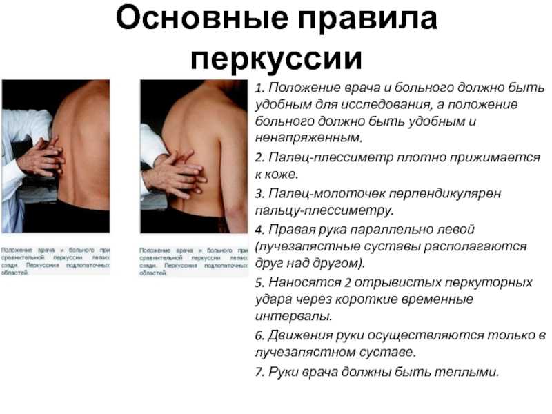   топографическая перкуссия - med24info.com