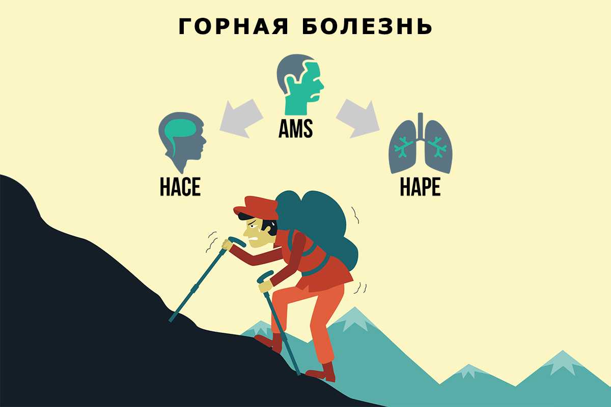 Как высота проживания влияет на наш жизненный тонус и самочувствие?