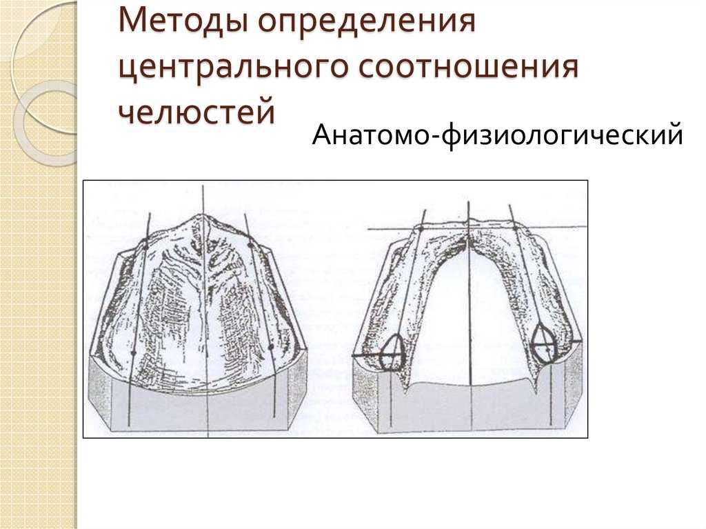 Анализатор hip плоскости или все гениальное просто