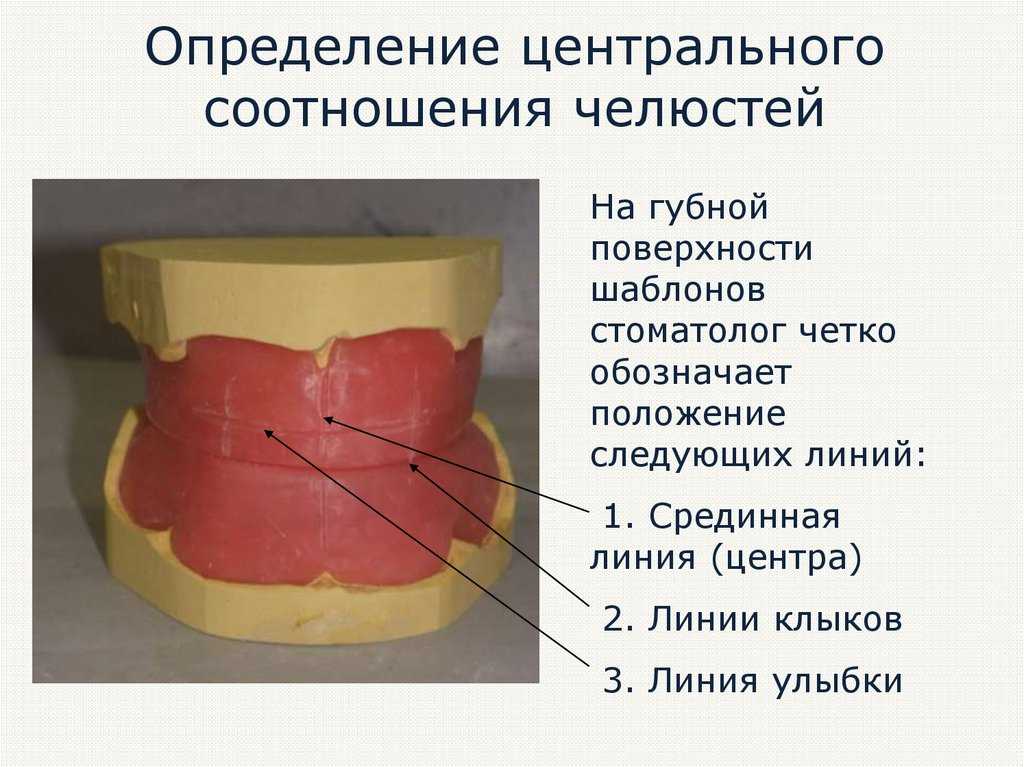 Топографические маркеры камперовской плоскости: особенности выбора и применения