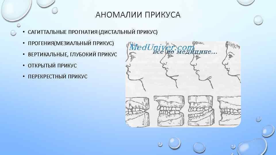 Prognathia латынь. Сагиттальныt аномалиb прикуса. Сагиттальные аномалии окклюзии.