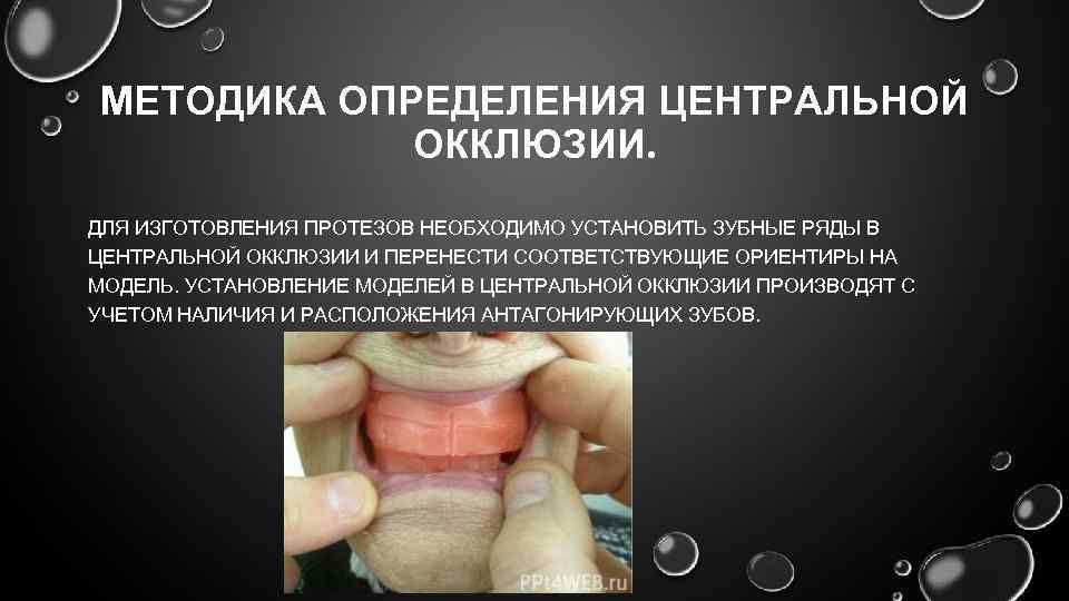 Методы определения центрального соотношения челюстей (мыщелков) | статья в журнале «молодой ученый»