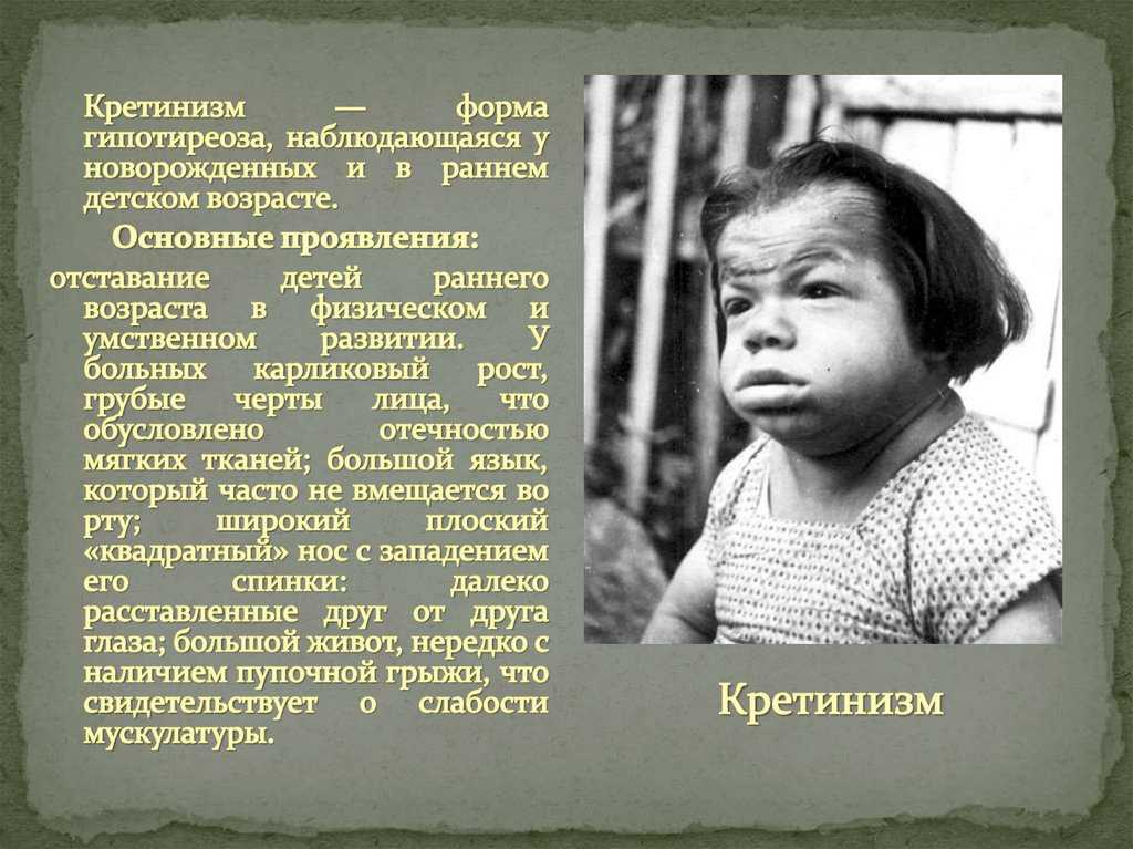 Картографический кретинизм: что это такое и как он влияет на картографию
