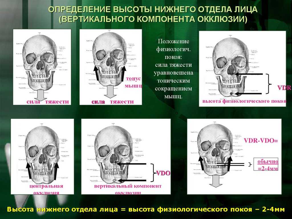 Артикулы системы sam  и их применение