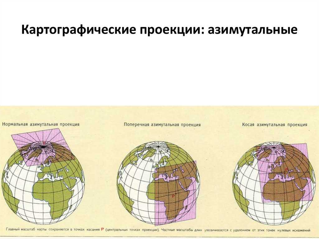 Какие импланты выбрать — круглые или анатомические
